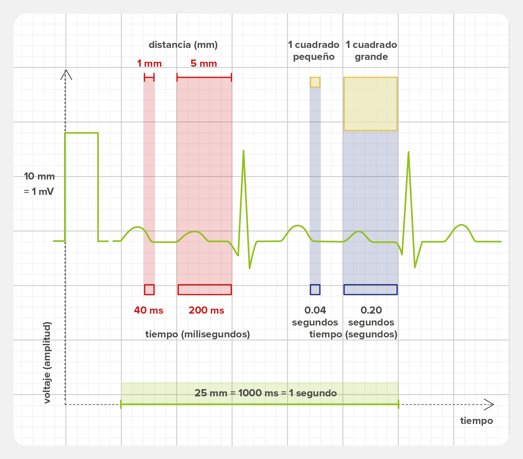Distancias en el gráfico o en el papel del ECG