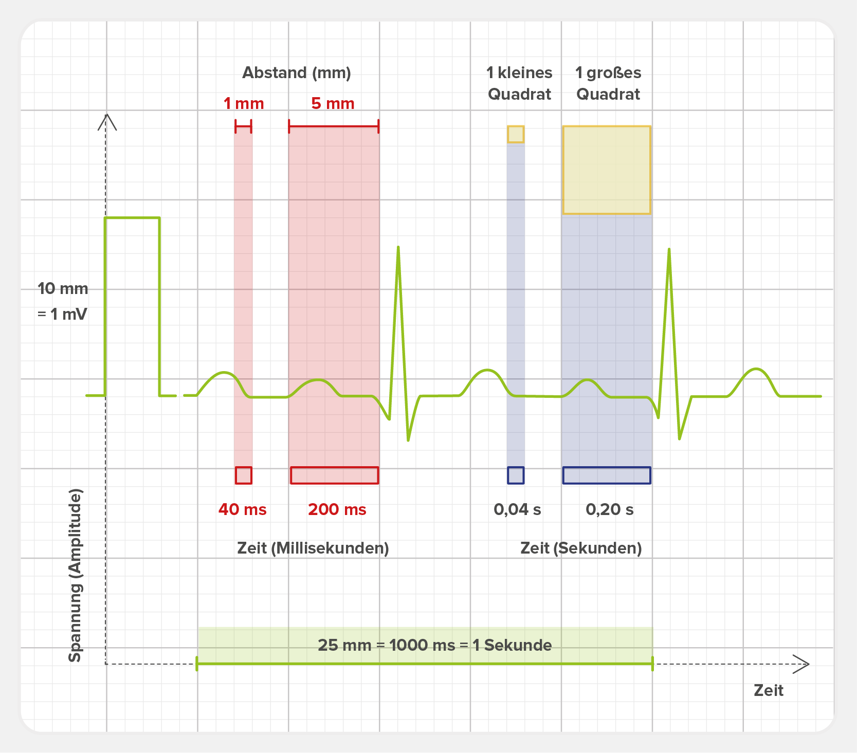 Abstände auf dem EKG-Papier