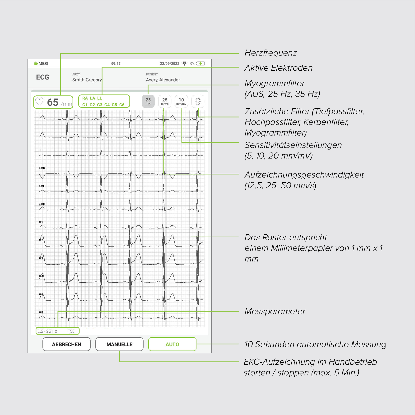 Aperçu pratique de l’écran d’enregistrement sur MESI mTABLET ECG