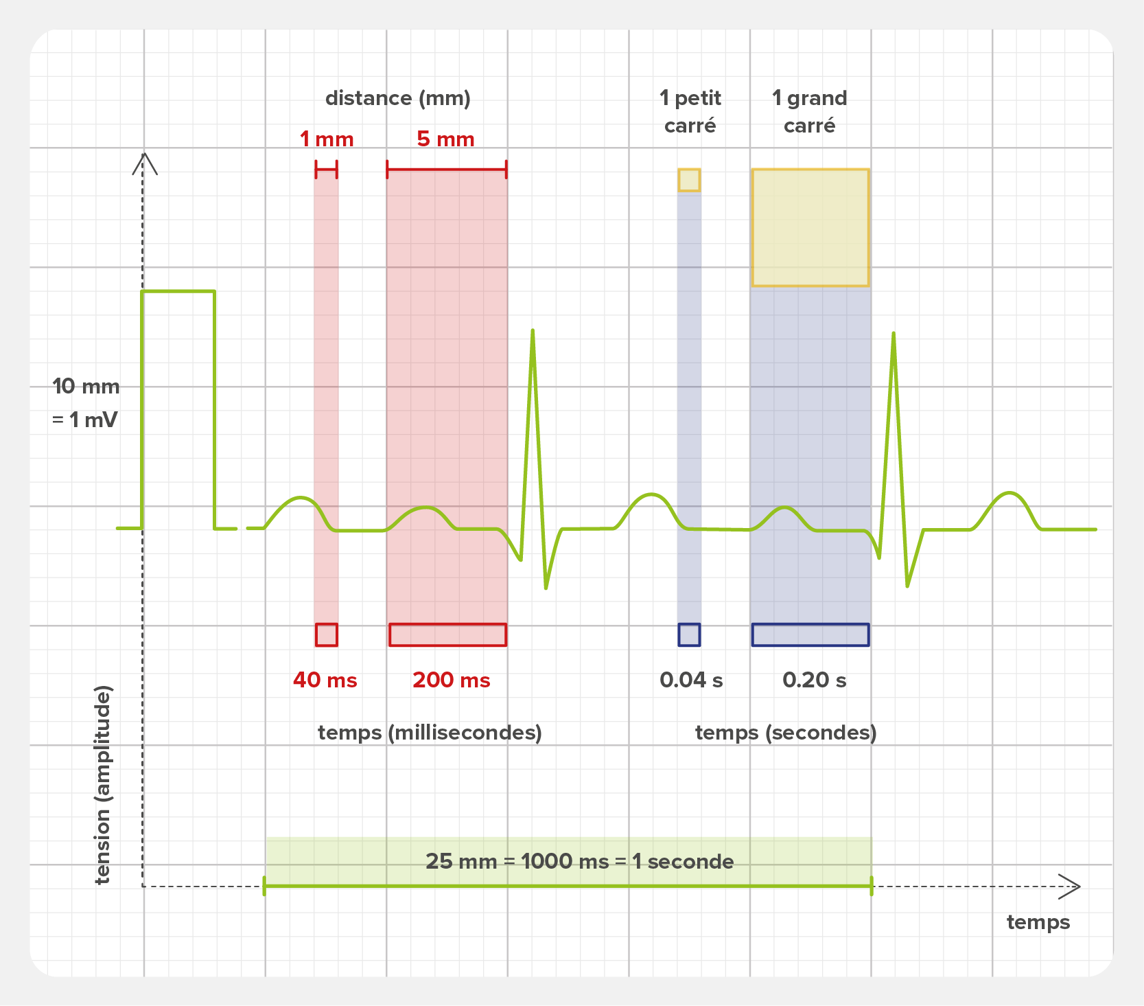 Distances sur le papier ou le graphique ECG