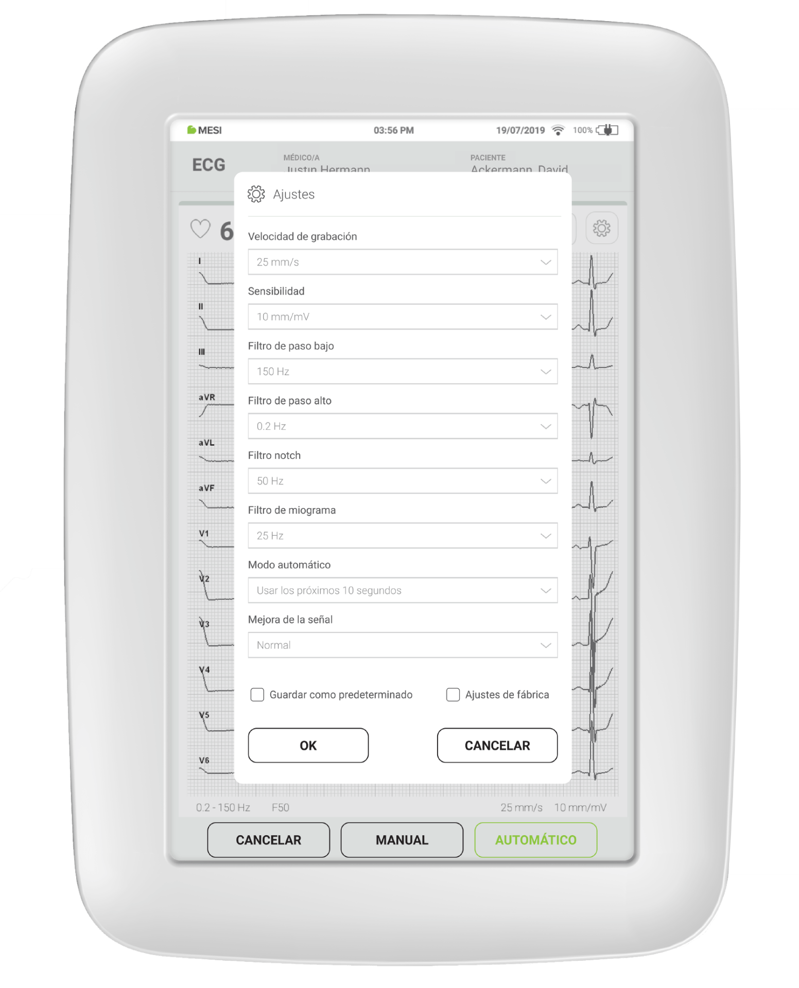 Cómo suelen establecerse los filtros