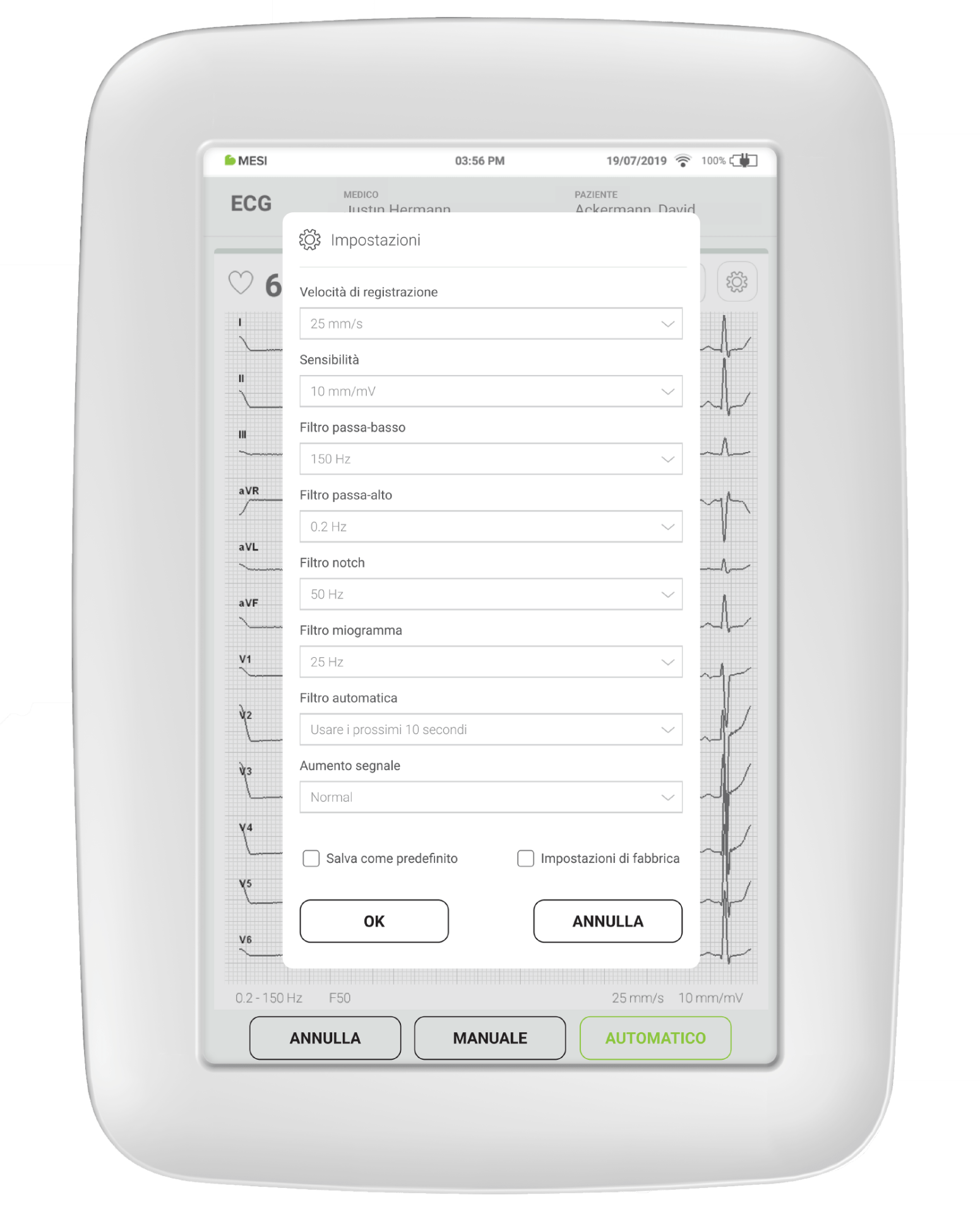 How filters are usually set