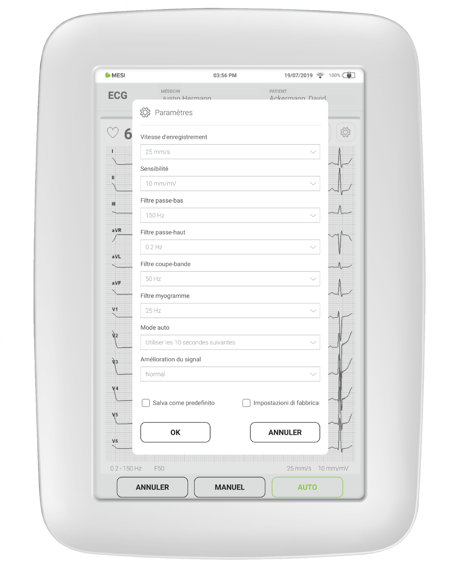 Comment les filtres sont généralement réglés