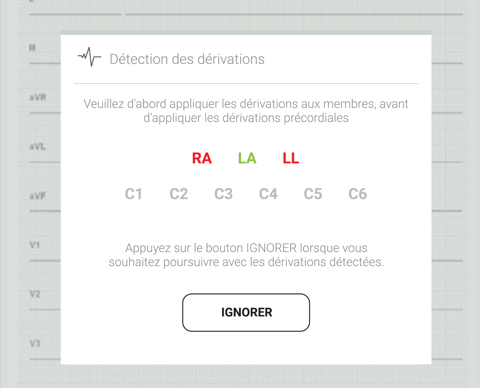 Sur l’écran de MESI mTABLET ECG, les détections de dérivation sont marquées en rouge.
