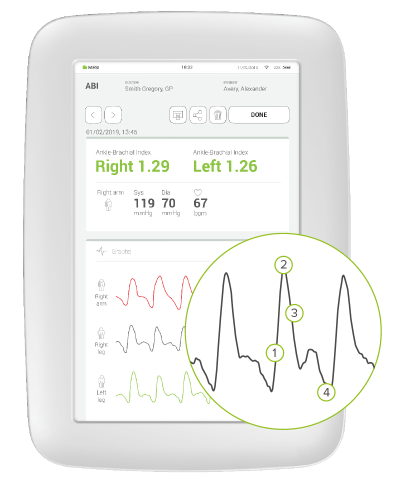 ABI pulse waveform recording and ABI reference scale