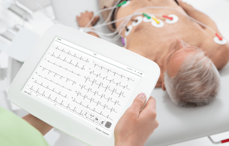 How to interpret the ECG