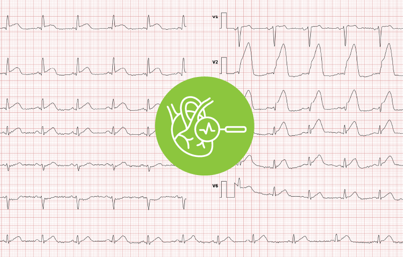 frequently-diagnosed-conditions-on-the-ecg.png