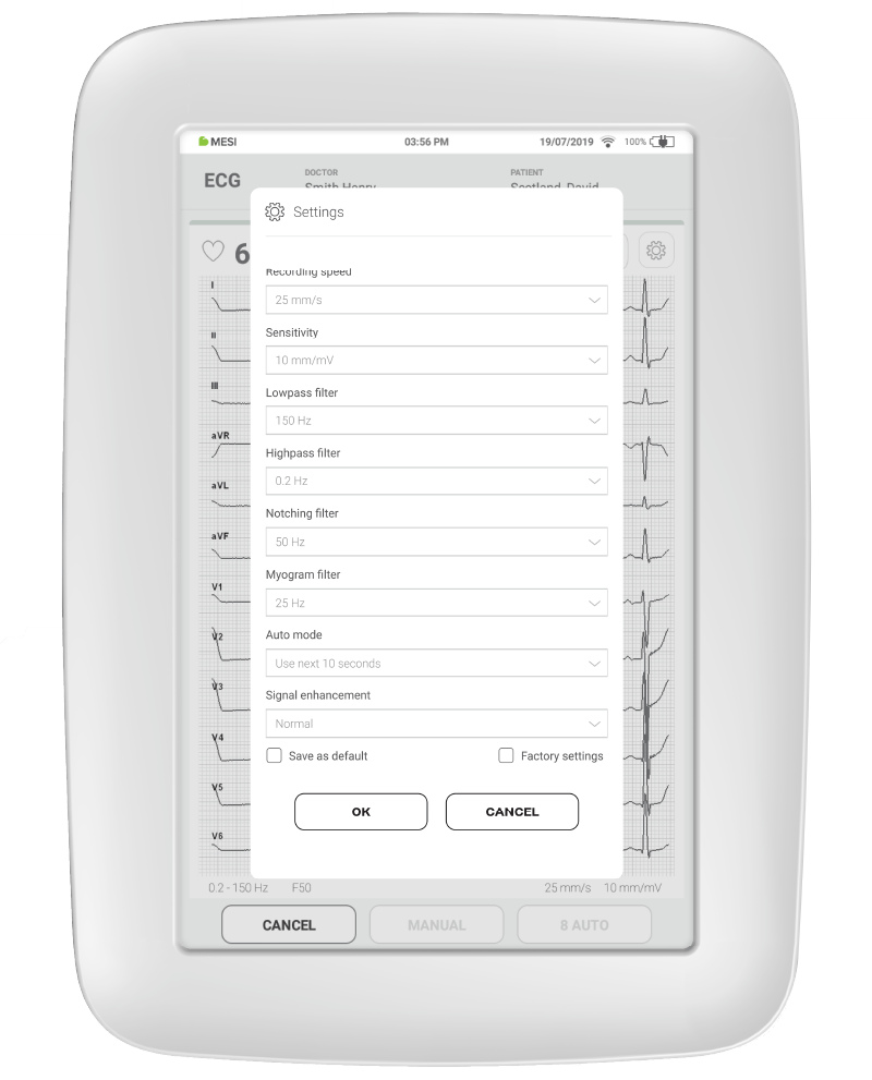 How-filters-are-usually-set