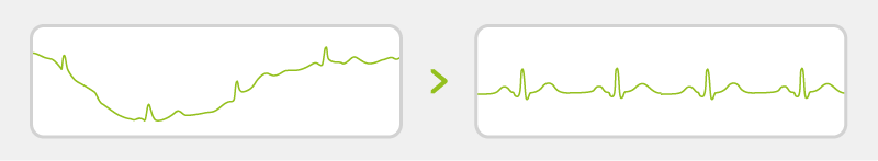 MESI-Signal-enhancement