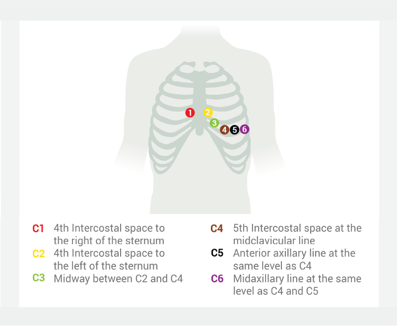 Patient-preparation-in-case-of-vacuum-electrodes