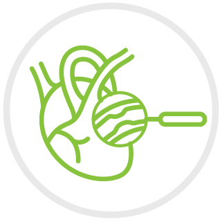 Coronary-artery-disease-CAD