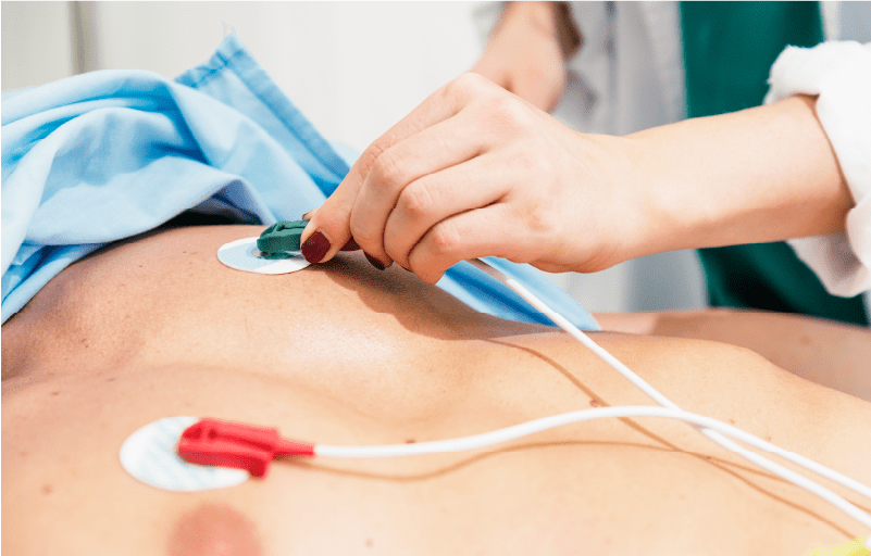 How to successfully perform an ECG