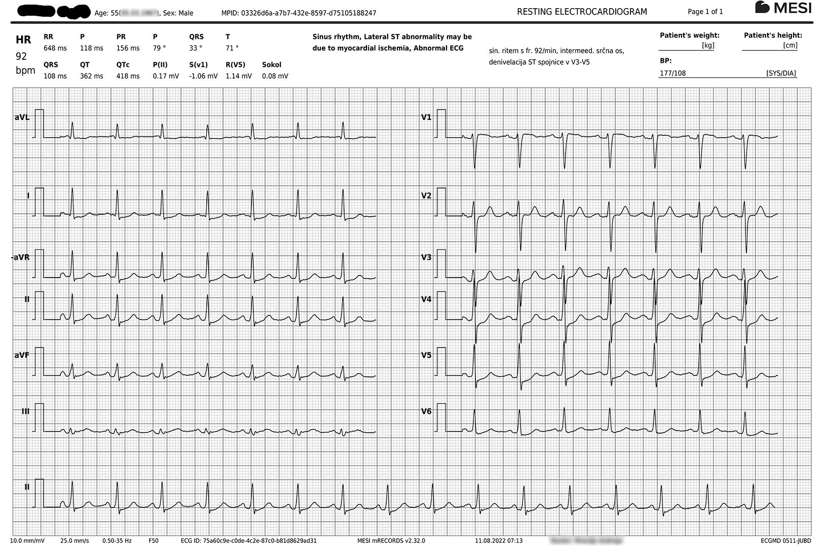 IK_EKG_blurred-lines