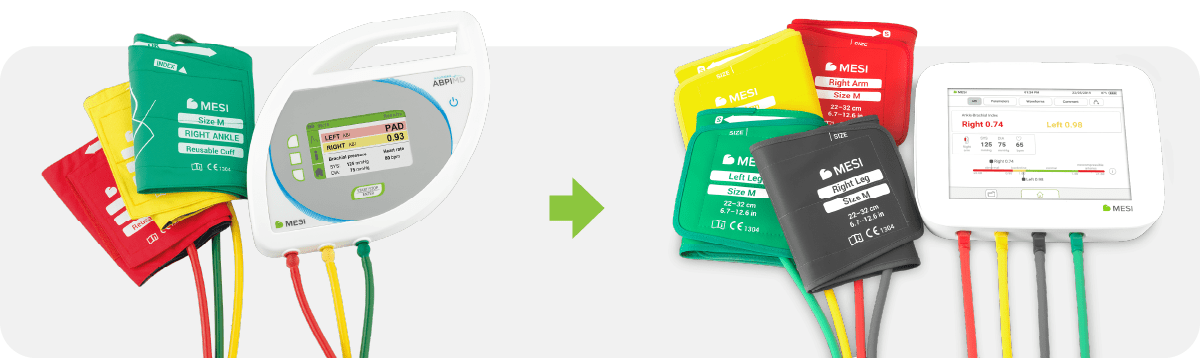 Worlds-fastest-Ankle-Brachial-Index-MESI-ABPI-MD