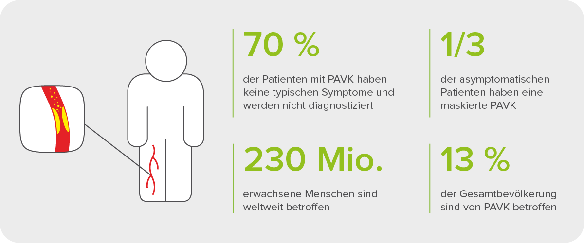 Periphere arterielle Verschlusskrankheit (PAVK), eine unterdiagnostizierte Erkrankung
