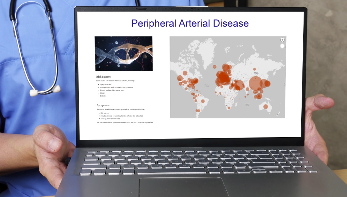 pad-awareness-month-the-latest-aha-scientific-statement-highlights-screening-and-prevention-as-essential