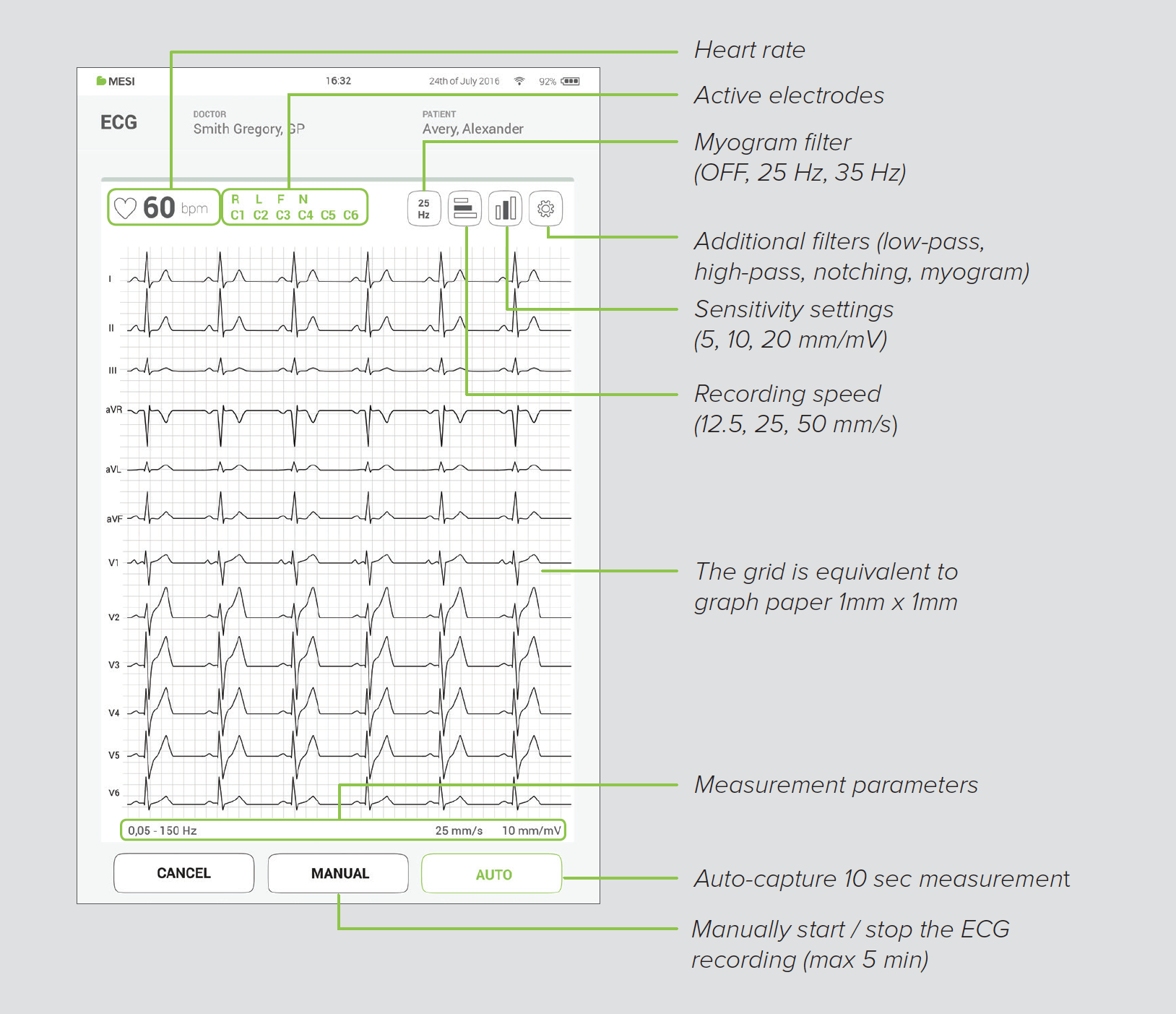 Practical overview of the recording screen on the MESI mTABLET ECG