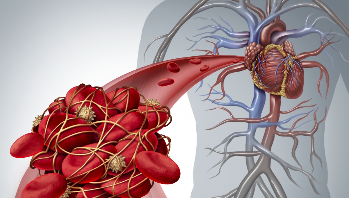 vascular-health-during-the-covid-19-pandemic