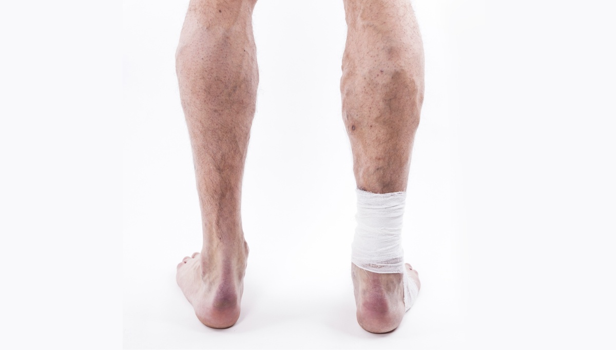 21 Questions to Ask a Patient with Chronic Wounds