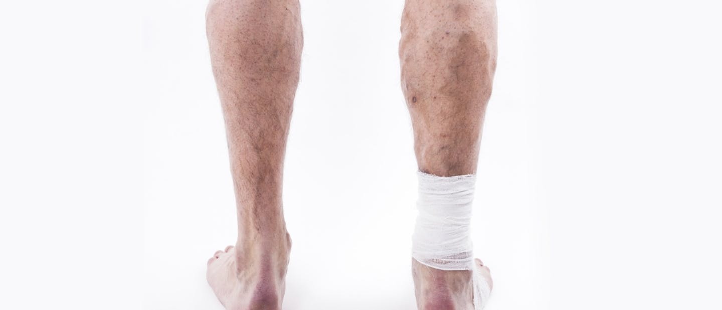 21 Questions to Ask a Patient with Chronic Wounds