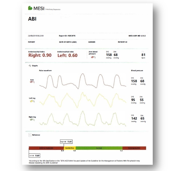 MESI ABPI MD-Ergebnisse