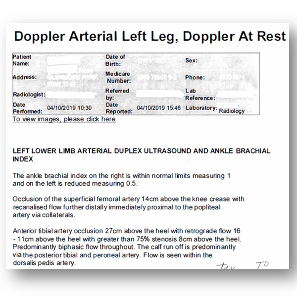 Doppler ultrasound exam results