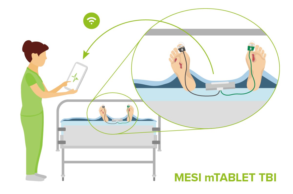 Use of Toe-Brachial Index (TBI) in wound care