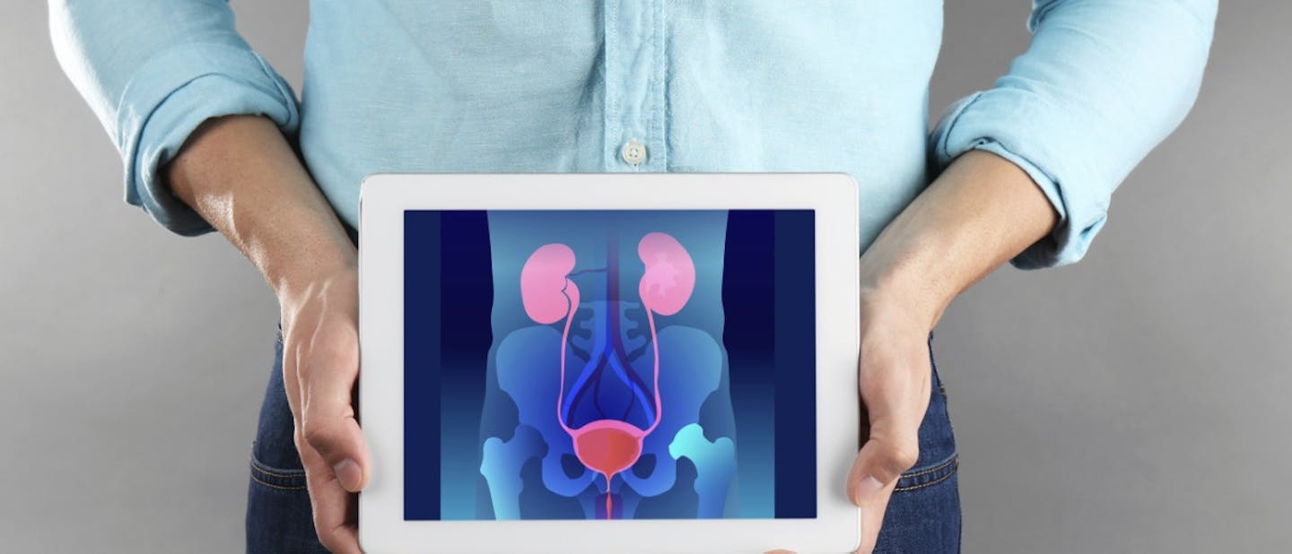 An Overview of Peripheral Arterial Disease (PAD) Guidelines for Nephrology