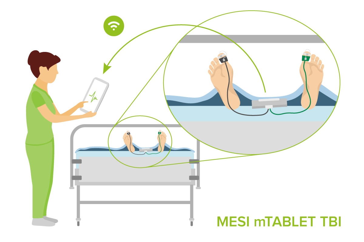 3 Reasons Why TBI Is Important for Proper Recovery