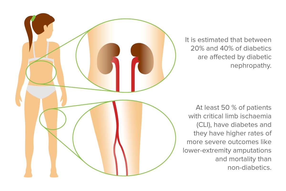 ankle-brachial-index-measurement-vs-toe-brachial-index-measurement-in-nephrology