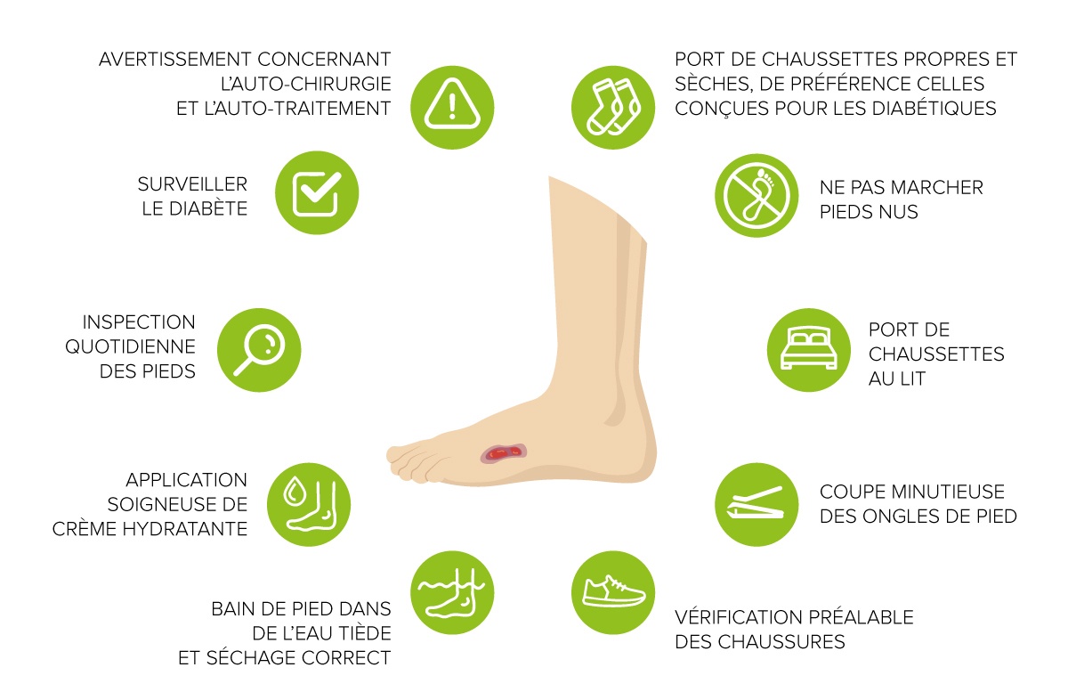 soins-des-pieds-chez-les-diabetiques