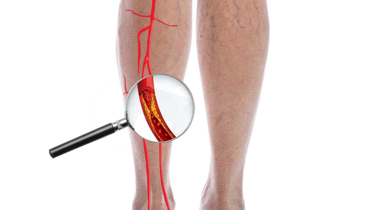 Improving patient outcomes in cardiology