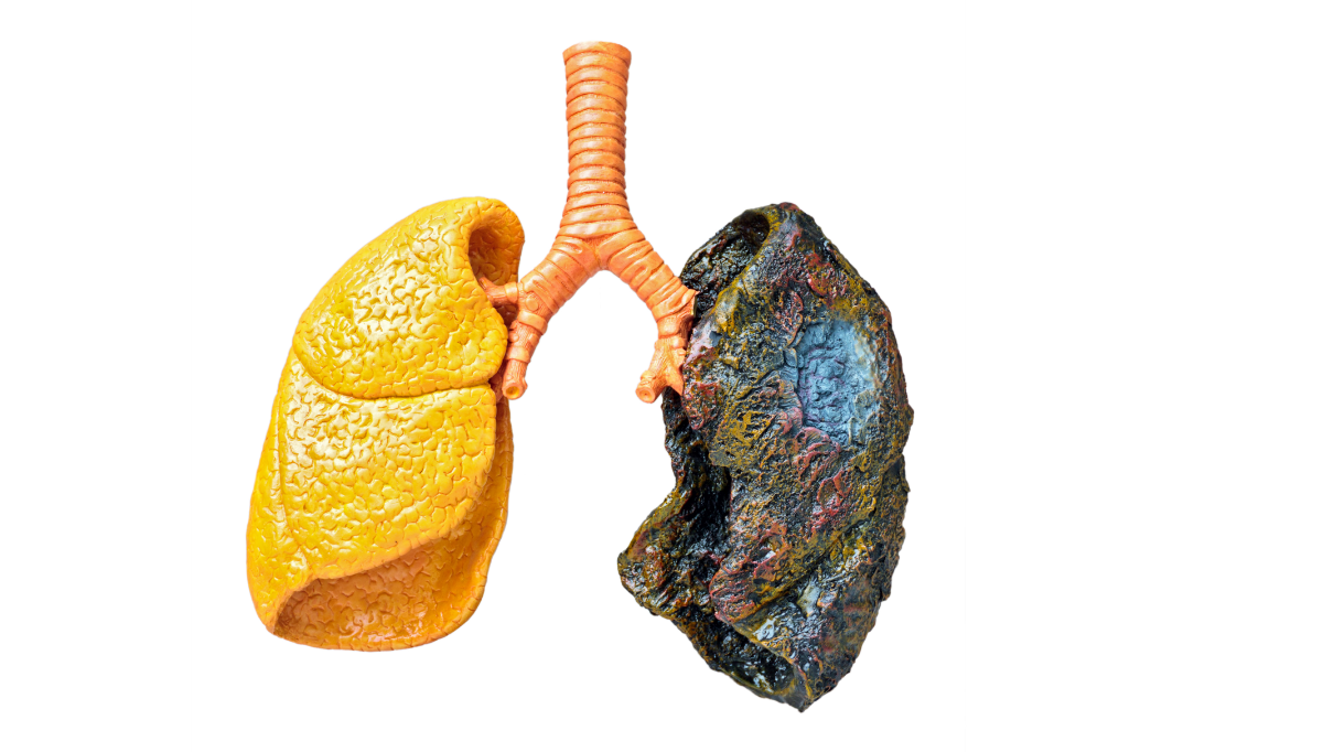 The Effect of Smoking on Ankle-Brachial Index (ABI)