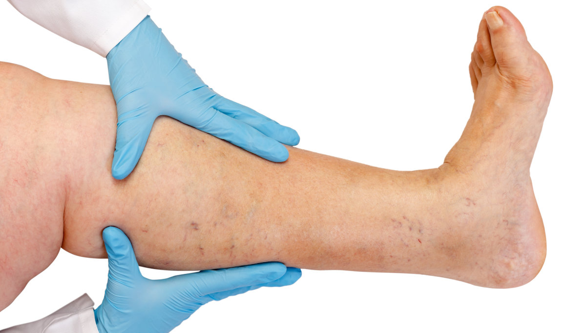 Arterial assessment as a diagnostic tool