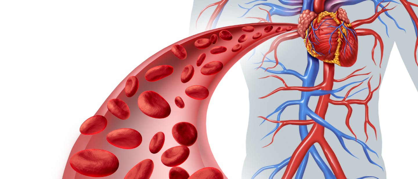 Impact of Peripheral Arterial Disease (PAD) on other diseases