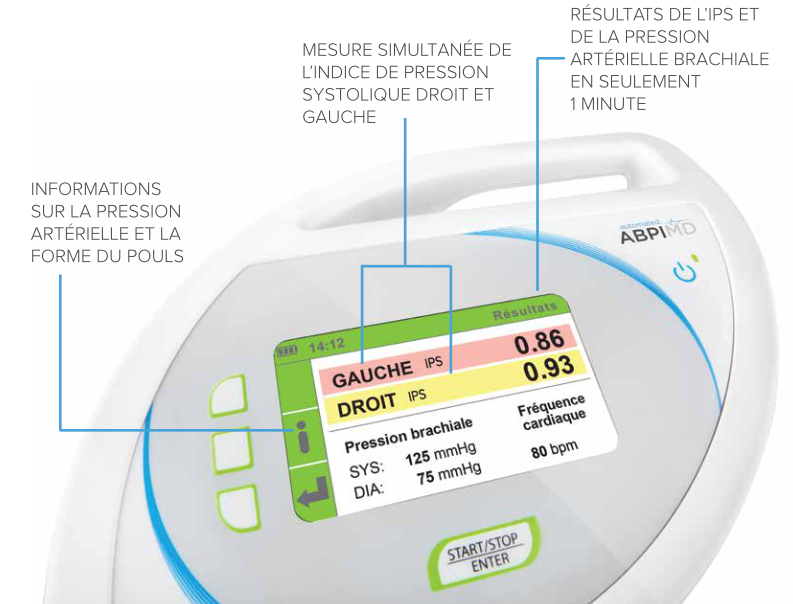 Échelle de référence du dépistage l’IPS