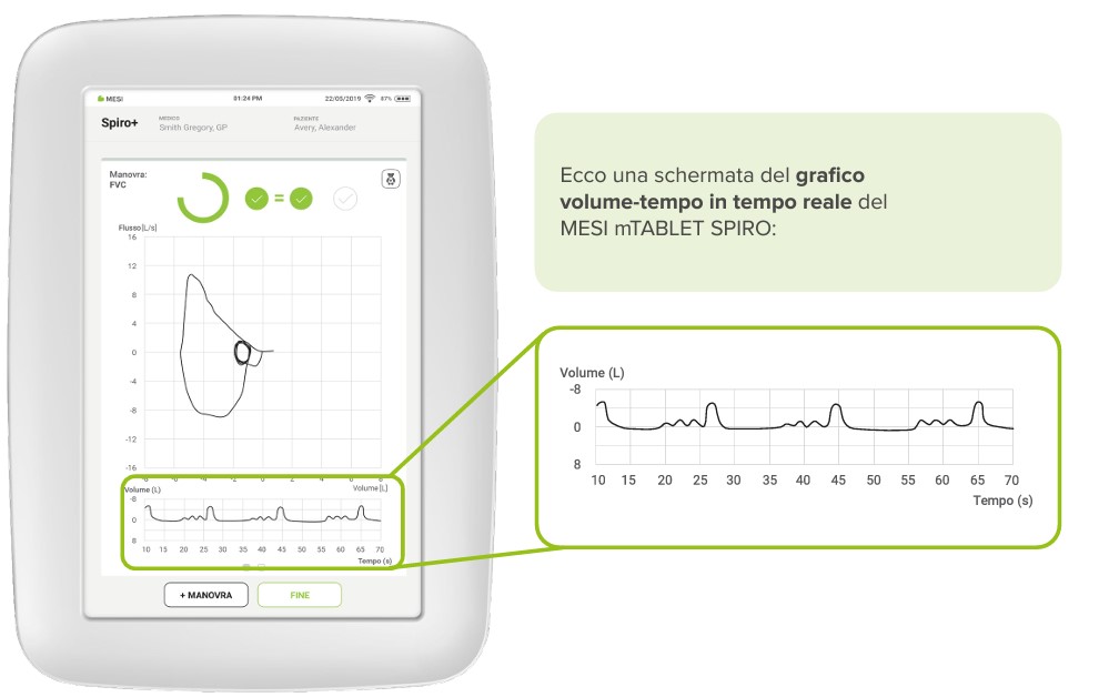 Grafico volume tempo in tempo reale
