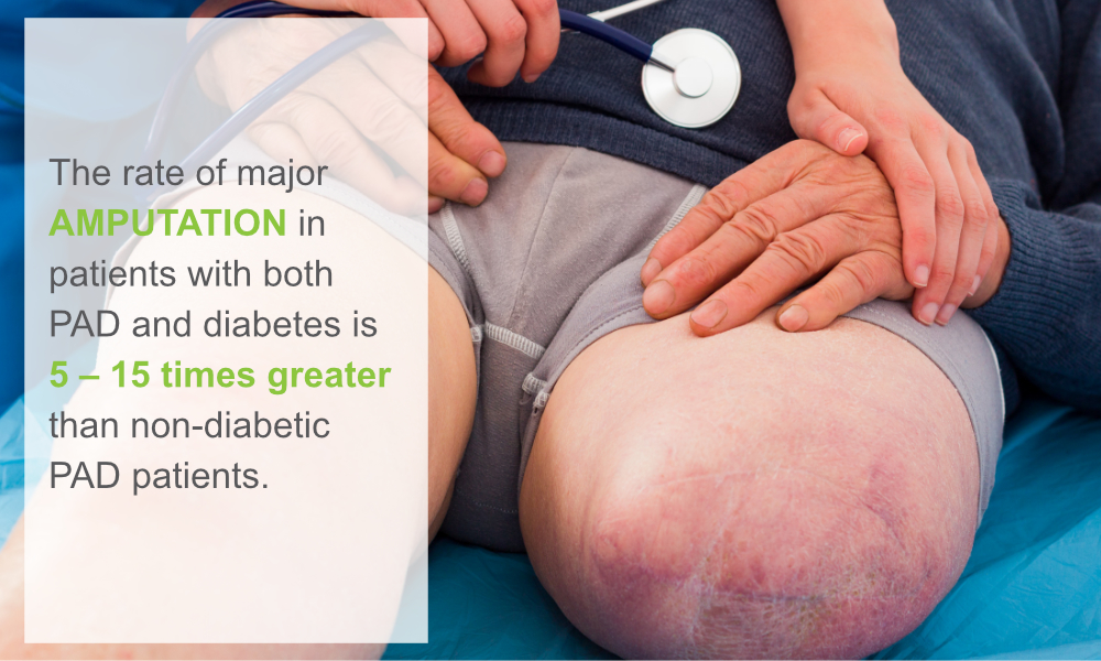 The Effect of Diabetes on Ankle-Brachial Index (ABI)