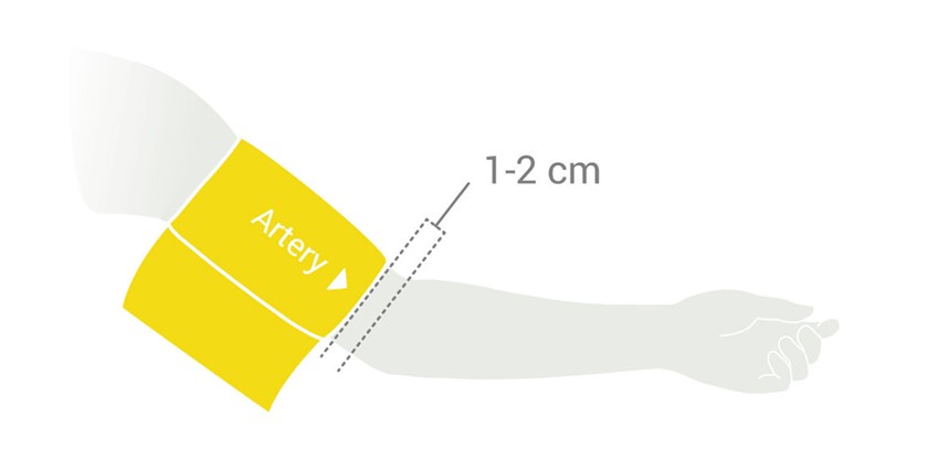 MESI mTABLET ABI - Cuff placement - Arm cuff