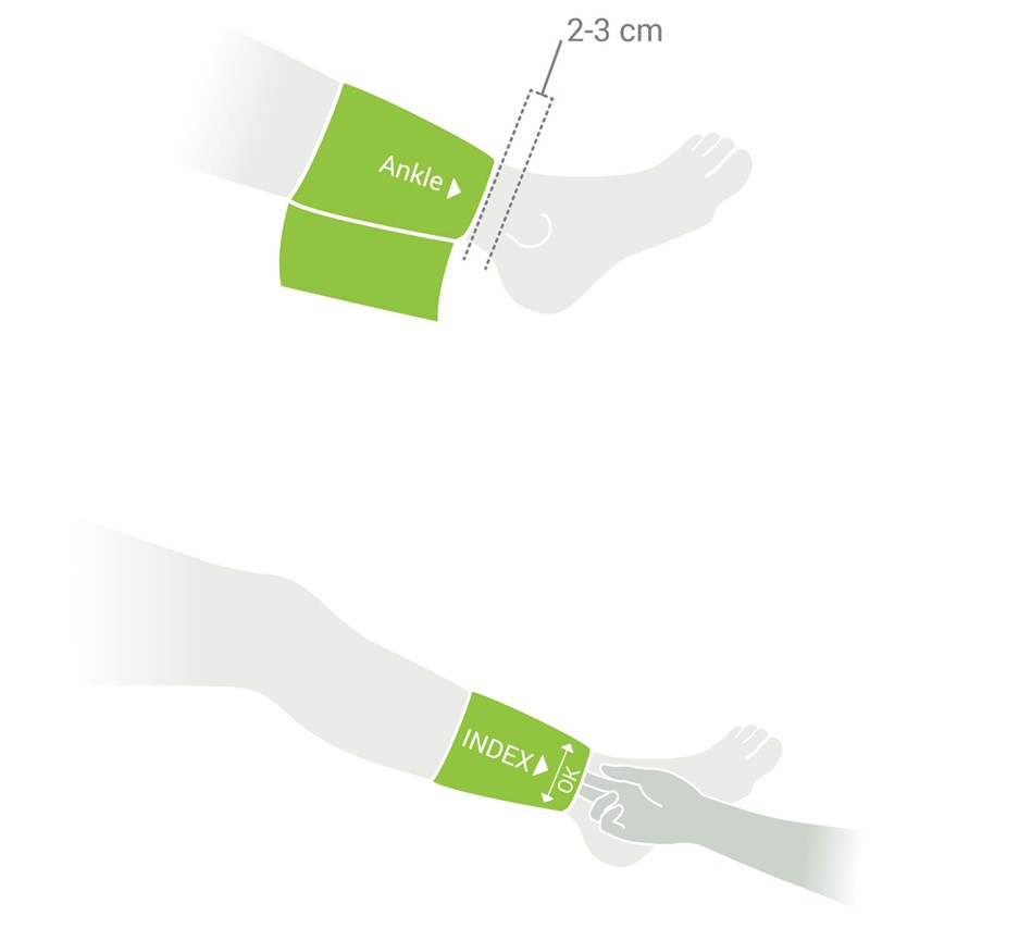 MESI mTABLET ABI - Cuff placement - Ankle cuff