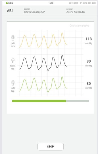 MESI mTABLET ABI - Performing an ABI measurement - Step 6