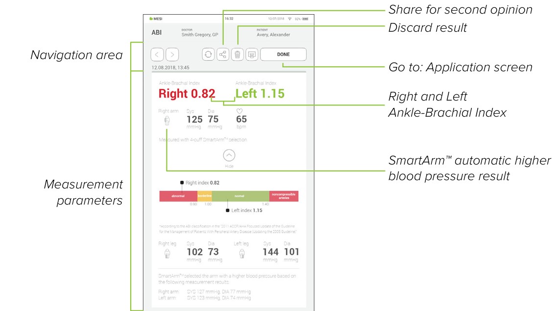 MESI mTABLET ABI - Reviewing an abi measurement - Step 1