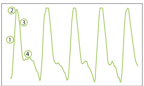 MESI mTABLET ABI - Pulse waveform - Image 01
