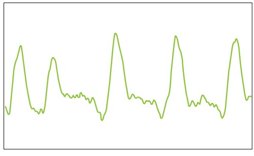 MESI mTABLET ABI - Pulse waveform - Image 02