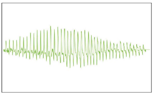 MESI mTABLET ABI - Normal oscilation graph