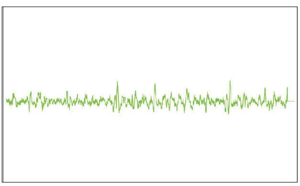 MESI mTABLET ABI - Severe PAD oscilation graph