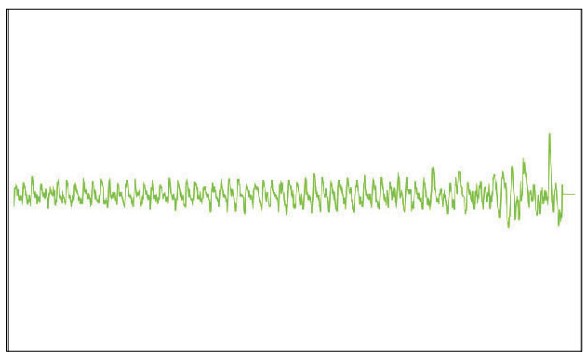 MESI mTABLET ABI - Incompressible arteriesoscilation graph