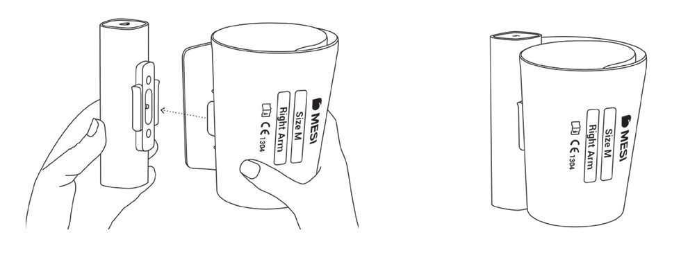 MESI mTABLET TBI - assembly of the cuff