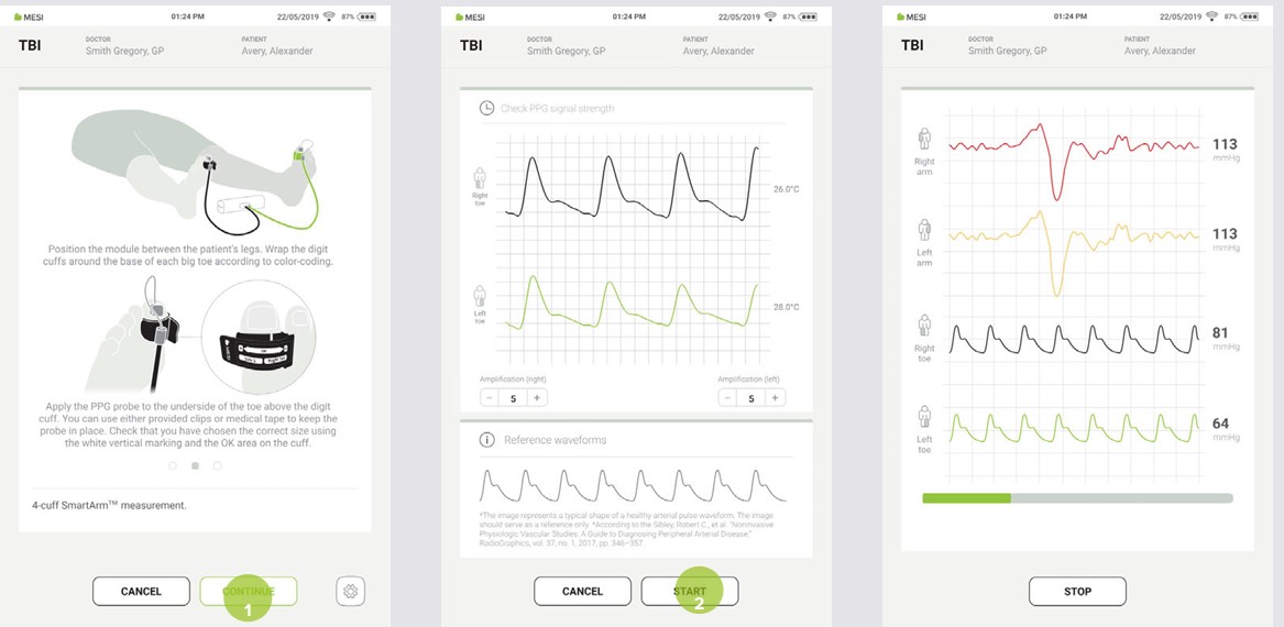 MESI mTABLET TBI - Performing TBI measurement - Step 5