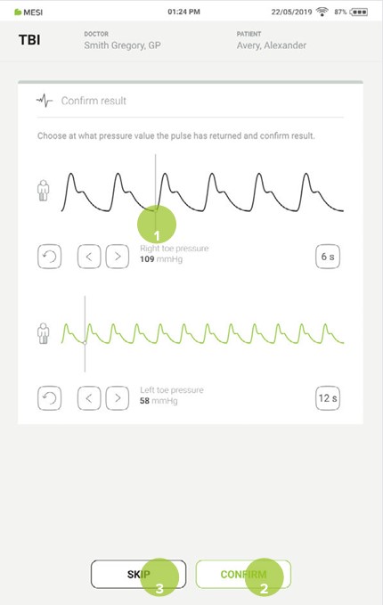 MESI mTABLET TBI - Performing TBI measurement - Step 6
